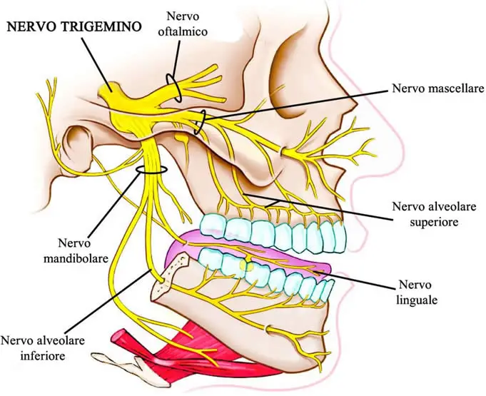 nervo trigemino complicazioni